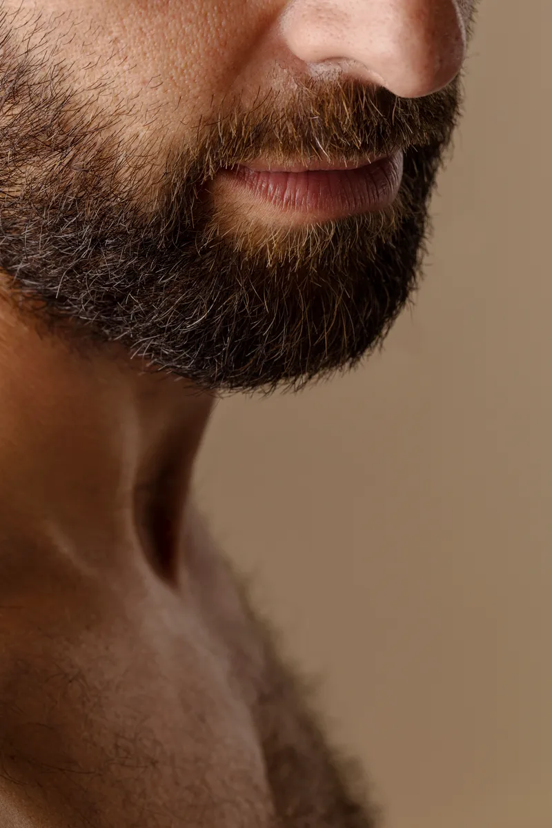 Transplante de barba